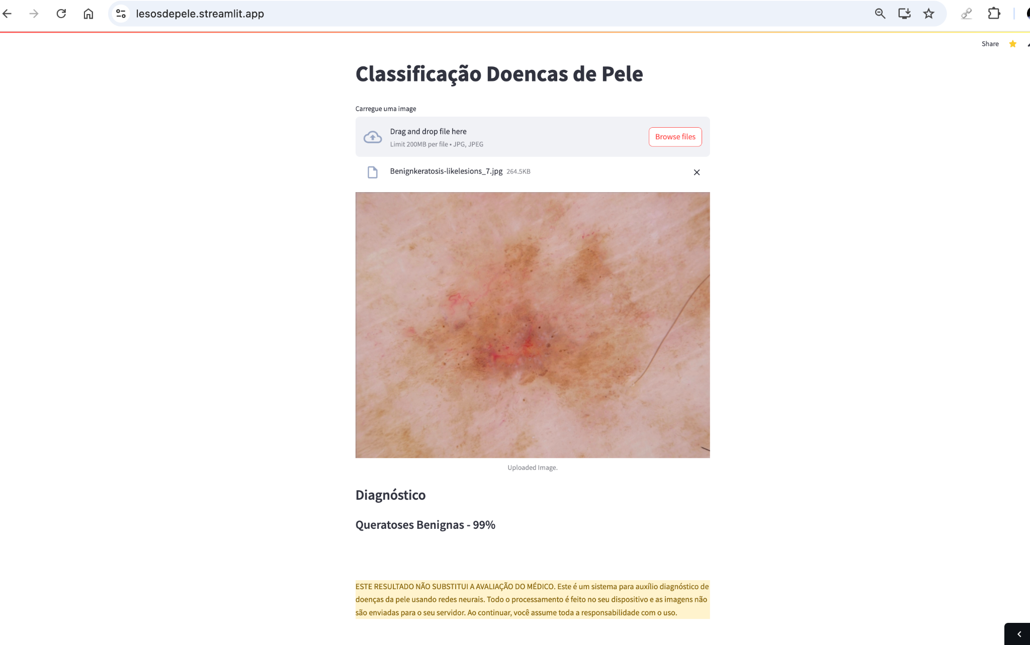 DermatologyAI