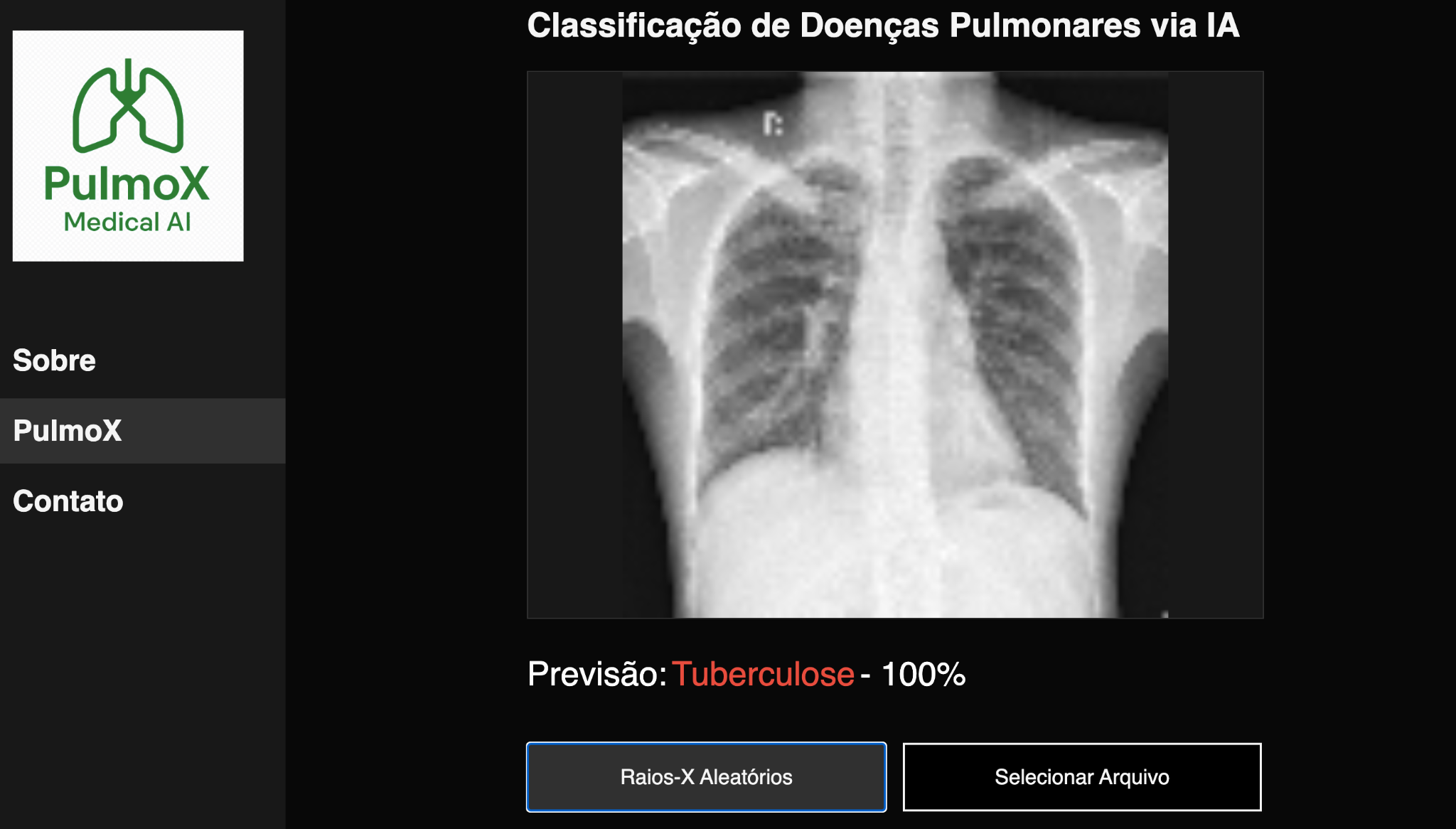 PulmoX Medical AI